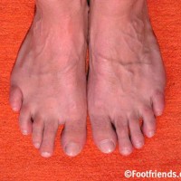 Dylan West shows his feet - Picture 11