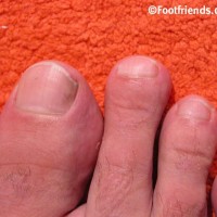Dylan West shows his feet - Picture 12