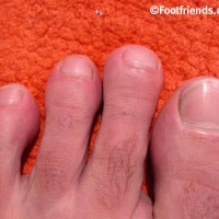 Dylan West shows his feet - Picture 13