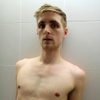 Axle Dean strips - Picture 1