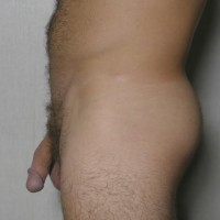 Anthony - Picture 10