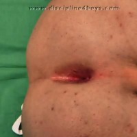 Perverse Doctors - Picture 45