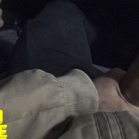 Hot facial - Picture 3