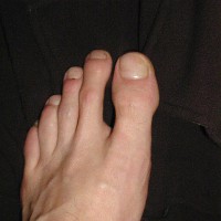 His long toes - Picture 18