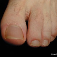 His long toes - Picture 38