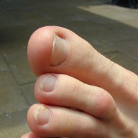 Mr. Gay London shows off his feet - Picture 22