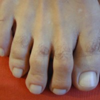 Foot guy - Picture 11