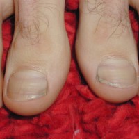Hot feet - Picture 21