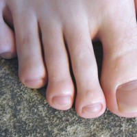 Patrick shows his feet - Picture 22