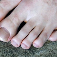 Patrick shows his feet - Picture 23