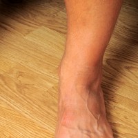 Joe show his musles and feet - Picture 37