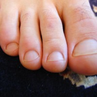Ridgeway show his feet - Picture 36