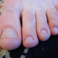 Ridgeway show his feet - Picture 37