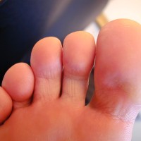 Ridgeway show his feet - Picture 39