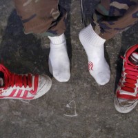 Rusty shows his feet - Picture 8
