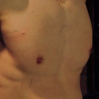 The cheated patient - Picture 18