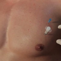Medical experiment with slave Denis - Picture 18