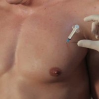 Medical experiment with slave Denis - Picture 15