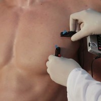 Medical experiment with slave Denis - Picture 28