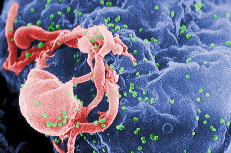 Coloured electron micrograph of a white blood cell with many small green spheres, virus particles, budding from its surface
